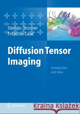 Diffusion Tensor Imaging: Introduction and Atlas Stieltjes, Bram 9783642204555 Springer-Verlag Berlin and Heidelberg GmbH &  - książka