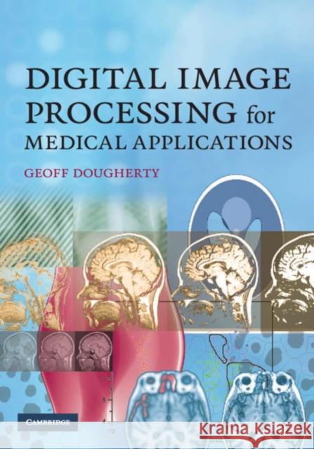 Digital Image Processing for Medical Applications Geoff Dougherty 9780521860857 Cambridge University Press - książka