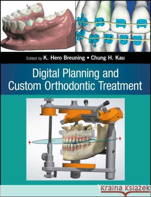 Digital Planning and Custom Orthodontic Treatment Kau, Chung How 9781119087779 John Wiley & Sons - książka