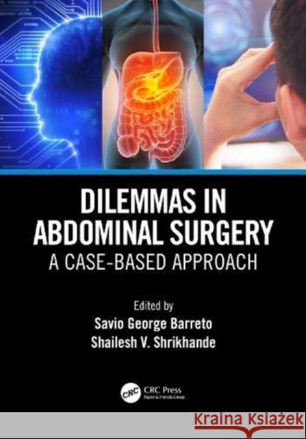 Dilemmas in Abdominal Surgery: A Case-Based Approach Savio George Alberto D Shailesh Vinayak Shrikhande 9780367187699 CRC Press - książka