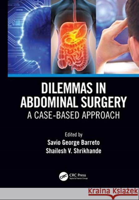 Dilemmas in Abdominal Surgery: A Case-Based Approach Savio George Alberto D Shailesh Vinayak Shrikhande 9780367559014 CRC Press - książka