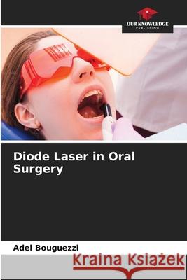 Diode Laser in Oral Surgery Adel Bouguezzi 9786202691857 Our Knowledge Publishing - książka