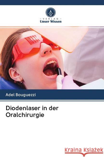 Diodenlaser in der Oralchirurgie Bouguezzi, Adel 9786202691833 Verlag Unser Wissen - książka