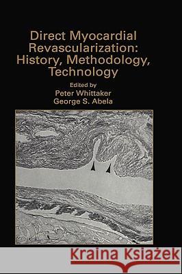 Direct Myocardial Revascularization: History, Methodology, Technology George S. Abela Peter A. Whittaker 9780792383987 Springer Netherlands - książka