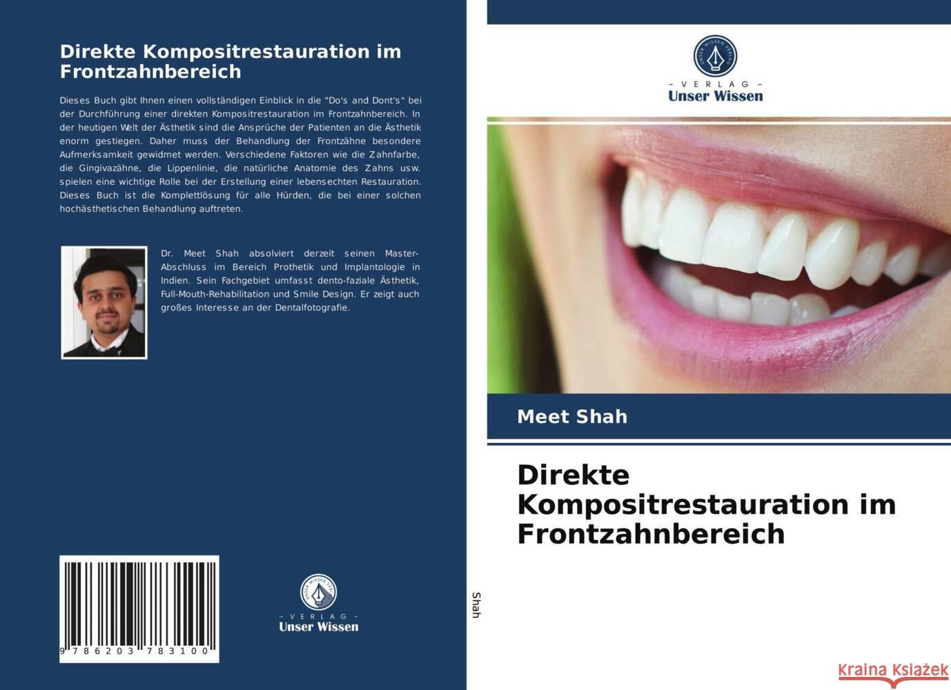 Direkte Kompositrestauration im Frontzahnbereich Shah, Meet 9786203783100 Verlag Unser Wissen - książka