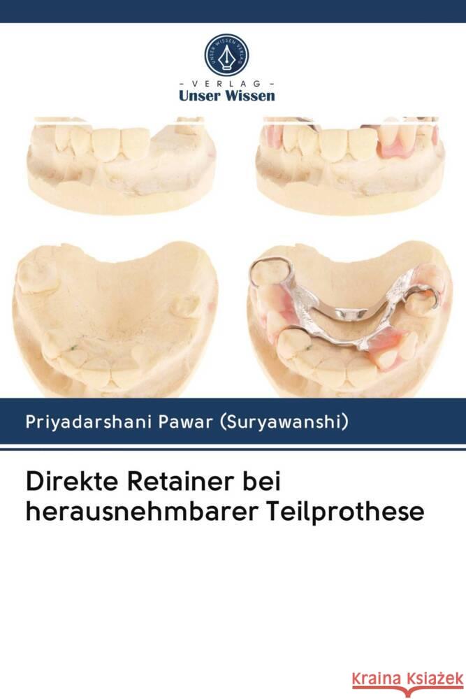 Direkte Retainer bei herausnehmbarer Teilprothese Pawar (Suryawanshi), Priyadarshani 9786203010251 Verlag Unser Wissen - książka