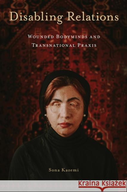 Disabling Relations: Wounded Bodyminds and Transnational PRAXIS Sona Kazemi 9781439922491 Temple University Press - książka