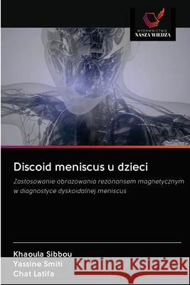 Discoid meniscus u dzieci Khaoula Sibbou Yassine Smiti Chat Latifa 9786203127607 Wydawnictwo Nasza Wiedza - książka