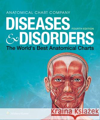 Diseases & Disorders: The World's Best Anatomical Charts Anatomical Chart Company 9781975110239 Wolters Kluwer Health - książka