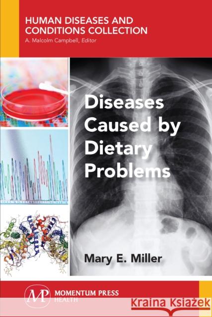 Diseases Caused by Dietary Problems Mary E. Miller 9781944749897 Momentum Press - książka