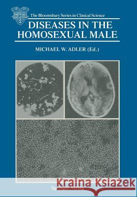 Diseases in the Homosexual Male Michael W. Adler 9781447116363 Springer - książka