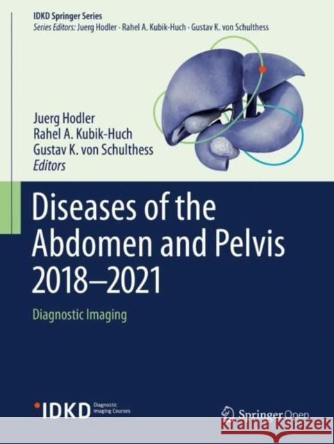 Diseases of the Abdomen and Pelvis 2018-2021: Diagnostic Imaging - Idkd Book Hodler, Juerg 9783319750187 Springer - książka