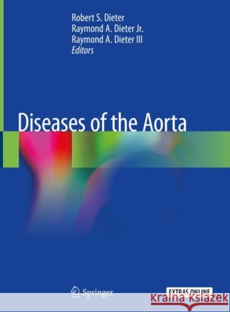 Diseases of the Aorta Robert Dieter Raymond A. Diete Raymond A. Diete 9783030113216 Springer - książka