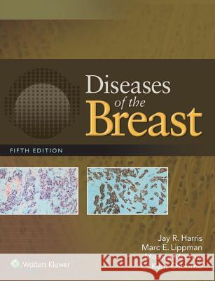 Diseases of the Breast 5e Harris, Jay R. 9781451186277 Lippincott Williams & Wilkins - książka