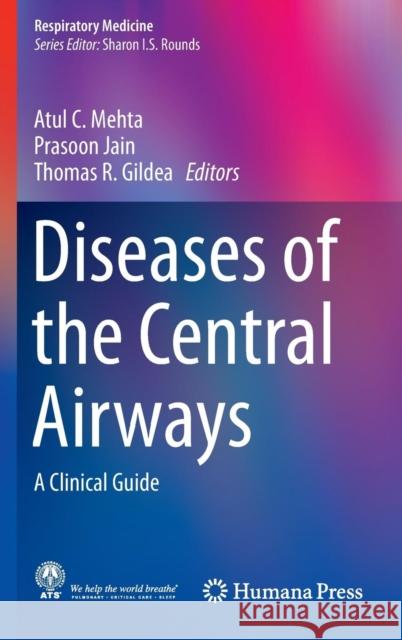 Diseases of the Central Airways: A Clinical Guide C. Mehta, Atul 9783319298283 Humana Press - książka