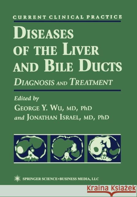 Diseases of the Liver and Bile Ducts: A Practical Guide to Diagnosis and Treatment Wu, George Y. 9781461272939 Humana Press - książka