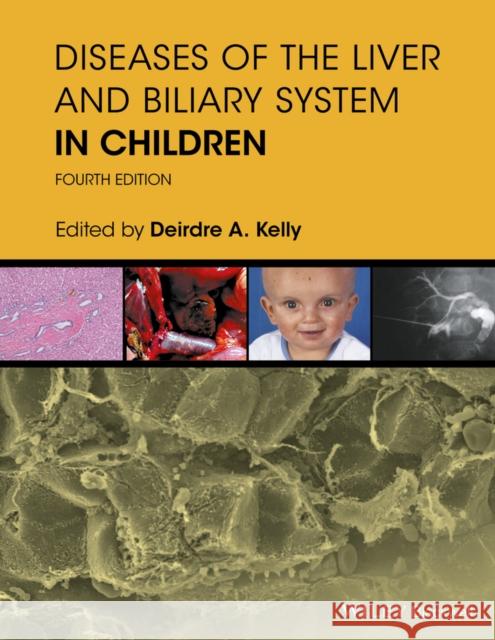 Diseases of the Liver and Biliary System in Children Kelly, Deirdre 9781119046905 John Wiley & Sons - książka