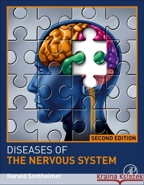 Diseases of the Nervous System Harald Sontheimer 9780128212288 Academic Press - książka