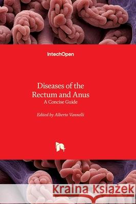 Diseases of the Rectum and Anus - A Concise Guide: A Concise Guide Alberto Vannelli 9781836345909 Intechopen - książka