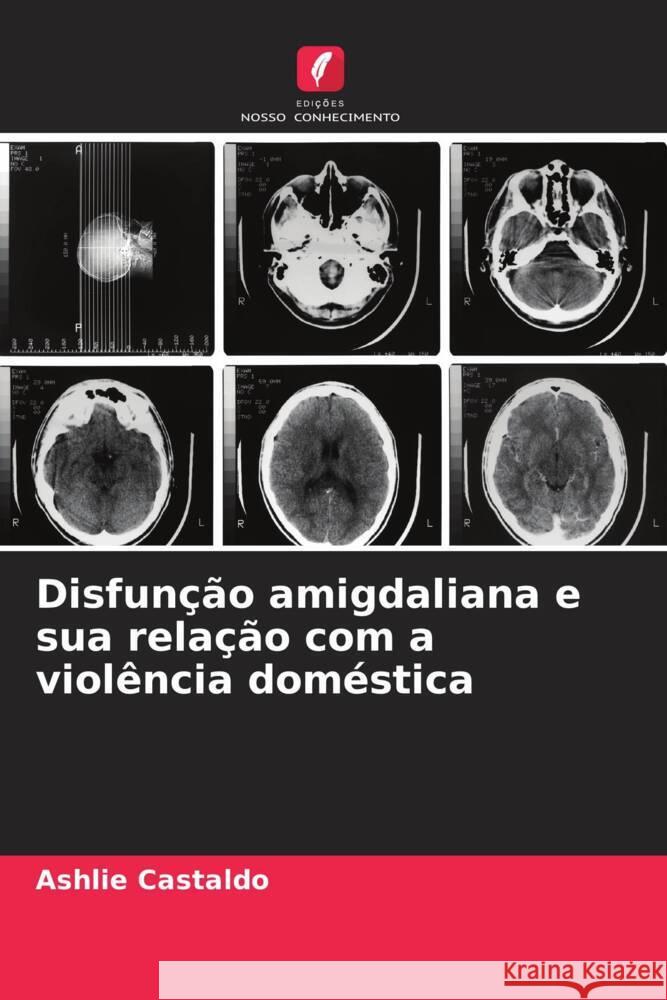 Disfun??o amigdaliana e sua rela??o com a viol?ncia dom?stica Ashlie Castaldo 9786207313785 Edicoes Nosso Conhecimento - książka