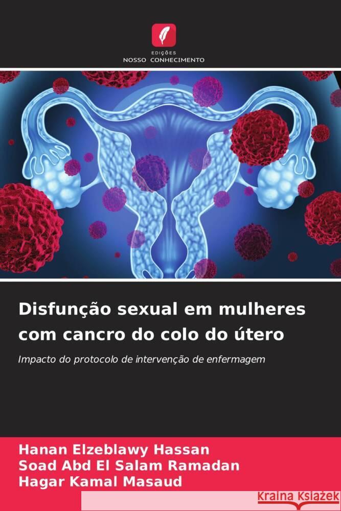 Disfun??o sexual em mulheres com cancro do colo do ?tero Hanan Elzeblawy Hassan Soad Abd El Salam Ramadan Hagar Kamal Masaud 9786207196654 Edicoes Nosso Conhecimento - książka