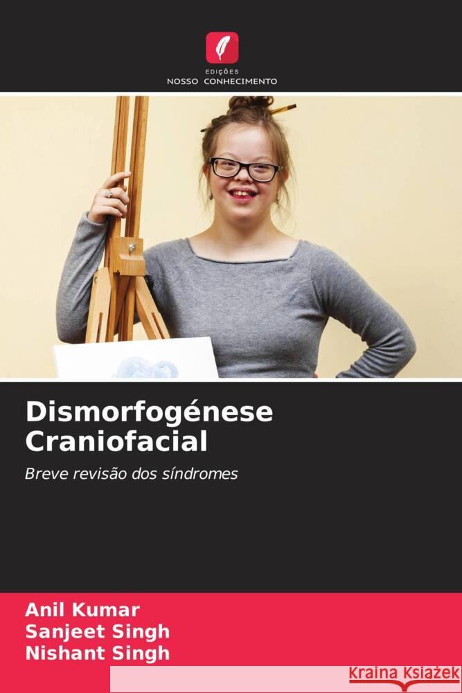 Dismorfogénese Craniofacial Kumar, Anil, Singh, Sanjeet, Singh, Nishant 9786204804835 Edições Nosso Conhecimento - książka