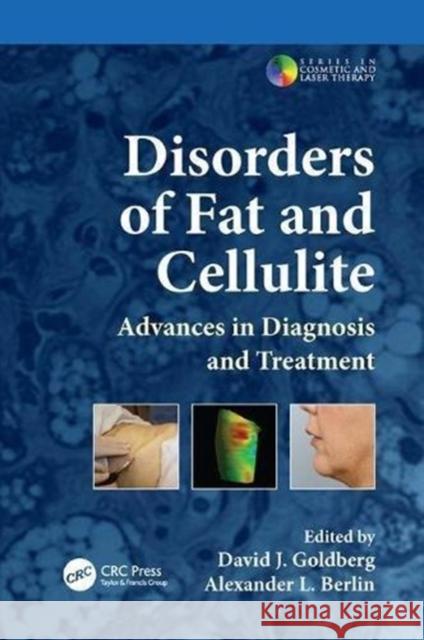 Disorders of Fat and Cellulite: Advances in Diagnosis and Treatment David J. Goldberg Alexander L. Berlin  9781138114661 CRC Press - książka