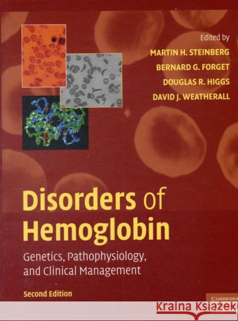 Disorders of Hemoglobin: Genetics, Pathophysiology, and Clinical Management Steinberg, Martin H. 9780521875196 Cambridge University Press - książka