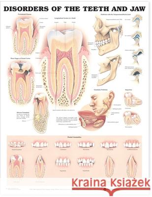 Disorders of the Teeth and Jaw Anatomical Chart   9781587792502  - książka
