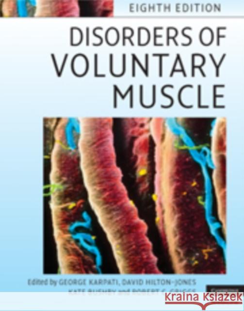 Disorders of Voluntary Muscle George Karpati David Hilton-Jones Kate Bushby 9780521876292 Cambridge University Press - książka