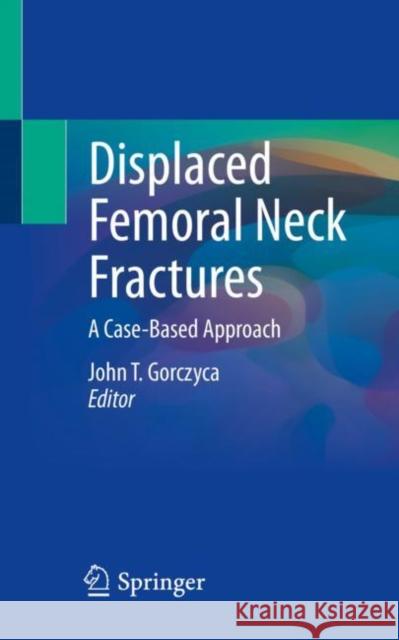 Displaced Femoral Neck Fractures: A Case-Based Approach John T. Gorczyca 9783030844431 Springer - książka