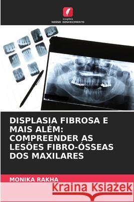 DISPLASIA FIBROSA E MAIS ALÉM: COMPREENDER AS LESÕES FIBRO-ÓSSEAS DOS MAXILARES RAKHA, MONIKA 9786208727727 Edições Nosso Conhecimento - książka