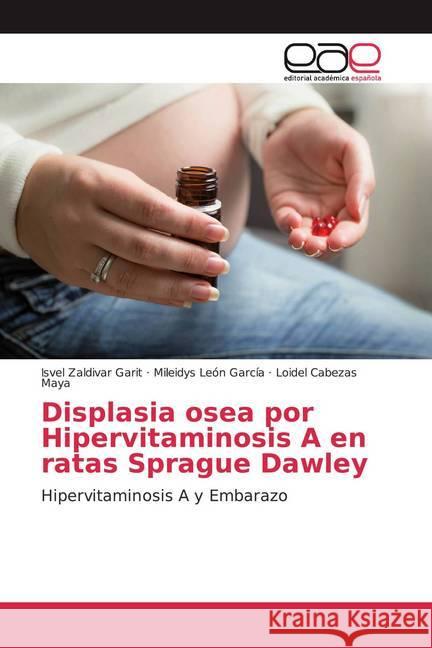 Displasia osea por Hipervitaminosis A en ratas Sprague Dawley : Hipervitaminosis A y Embarazo Zaldivar Garit, Isvel; León García, Mileidys; Cabezas Maya, Loidel 9786138992585 Editorial Académica Española - książka