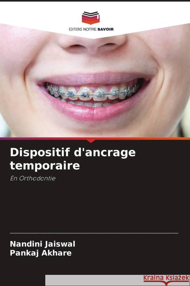Dispositif d'ancrage temporaire Jaiswal, Nandini, Akhare, Pankaj 9786204614182 Editions Notre Savoir - książka
