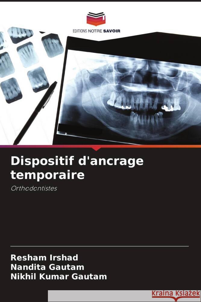 Dispositif d'ancrage temporaire Irshad, Resham, Gautam, Nandita, Gautam, Nikhil Kumar 9786205416006 Editions Notre Savoir - książka