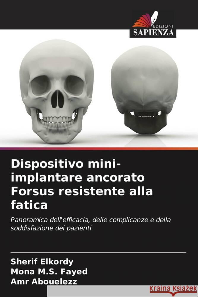 Dispositivo mini-implantare ancorato Forsus resistente alla fatica Elkordy, Sherif, M.S. Fayed, Mona, Abouelezz, Amr 9786206944126 Edizioni Sapienza - książka