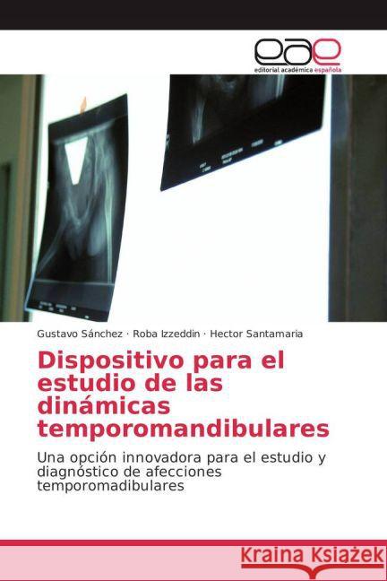 Dispositivo para el estudio de las dinámicas temporomandibulares : Una opción innovadora para el estudio y diagnóstico de afecciones temporomadibulares Sanchez, Gustavo; Izzeddin, Roba; Santamaria, Hector 9783841761477 Editorial Académica Española - książka