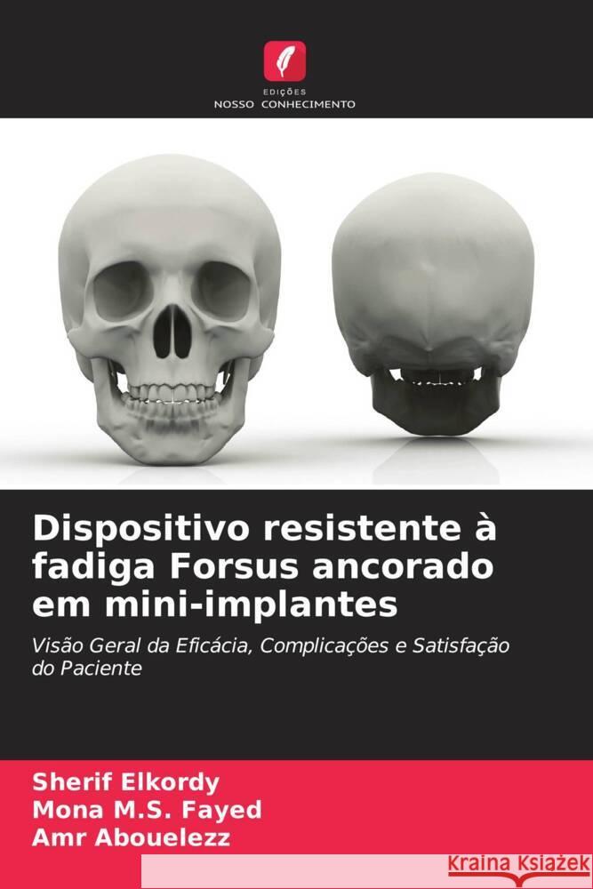 Dispositivo resistente à fadiga Forsus ancorado em mini-implantes Elkordy, Sherif, M.S. Fayed, Mona, Abouelezz, Amr 9786206944133 Edições Nosso Conhecimento - książka