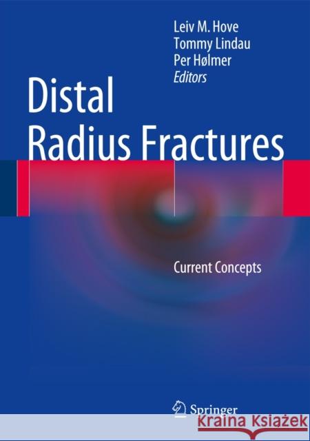 Distal Radius Fractures: Current Concepts Hove, Leiv M. 9783642546037 Springer - książka