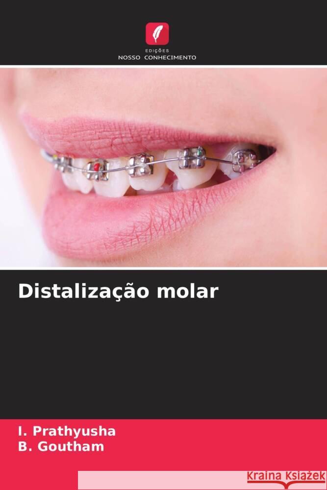 Distaliza??o molar I. Prathyusha B. Goutham 9786207387779 Edicoes Nosso Conhecimento - książka