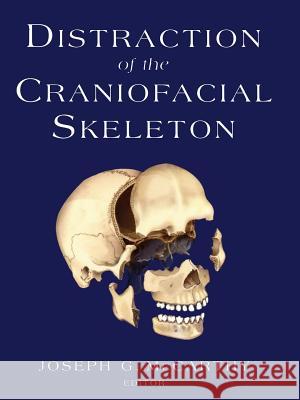 Distraction of the Craniofacial Skeleton Joseph G. McCarthy P. Tessier 9781461274292 Springer - książka