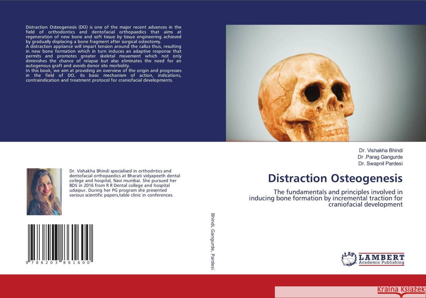 Distraction Osteogenesis Bhindi, Dr. Vishakha, Gangurde, Dr. Parag, Pardesi, Dr. Swapnil 9786203861600 LAP Lambert Academic Publishing - książka