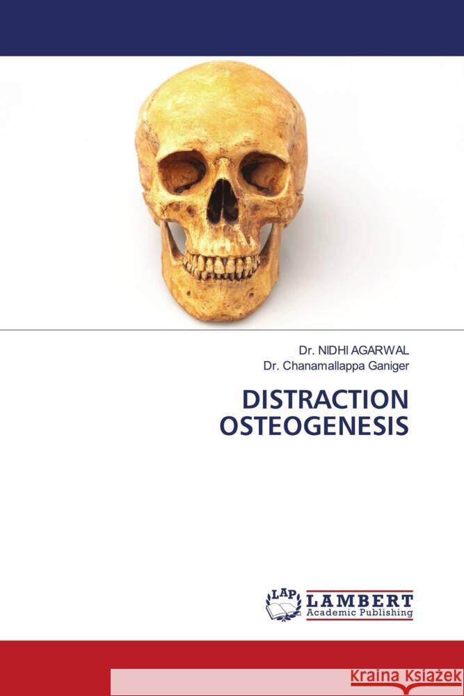 DISTRACTION OSTEOGENESIS AGARWAL, Dr. NIDHI, Ganiger, Dr. Chanamallappa 9786205498262 LAP Lambert Academic Publishing - książka