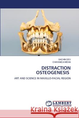 DISTRACTION OSTEOGENESIS DEV, SACHIN, MIDHA, CHAYANICA 9786208455316 LAP Lambert Academic Publishing - książka
