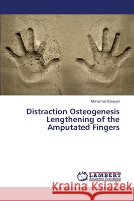 Distraction Osteogenesis Lengthening of the Amputated Fingers Mohamed Elsayed 9783330331587 LAP Lambert Academic Publishing - książka