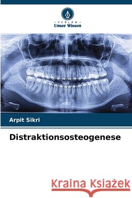Distraktionsosteogenese Arpit Sikri 9786207876433 Verlag Unser Wissen - książka