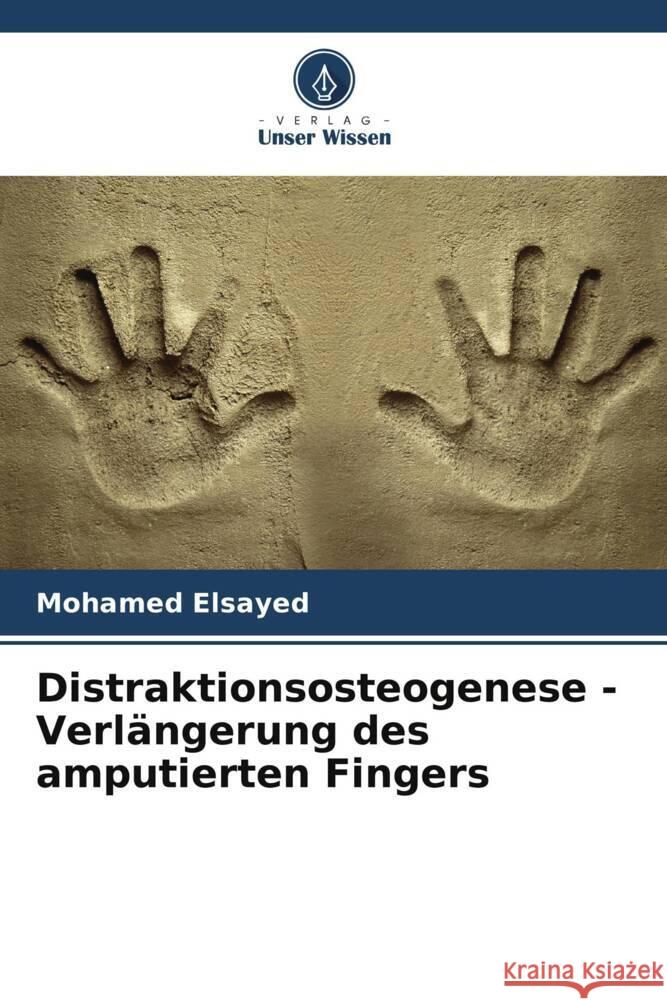 Distraktionsosteogenese - Verlängerung des amputierten Fingers Elsayed, Mohamed 9786208199173 Verlag Unser Wissen - książka