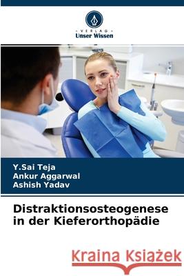 Distraktionsosteogenese in der Kieferorthopädie Y Sai Teja, Ankur Aggarwal, Ashish Yadav 9786204148007 Verlag Unser Wissen - książka