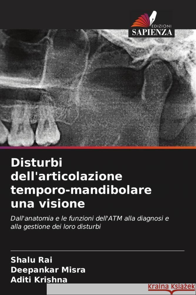 Disturbi dell'articolazione temporo-mandibolare una visione Rai, Shalu, Misra, Deepankar, Krishna, Aditi 9786204152622 Edizioni Sapienza - książka