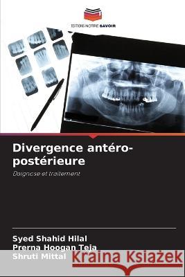 Divergence ant?ro-post?rieure Syed Shahid Hilal Prerna Hoogan Teja Shruti Mittal 9786205869888 Editions Notre Savoir - książka